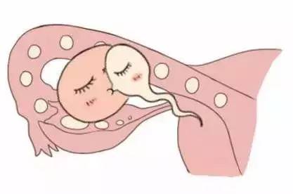 供卵代生公司生殖中心
